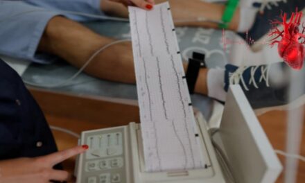 Bradiaritmia: cure, sintomi, diagnosi, guarigione