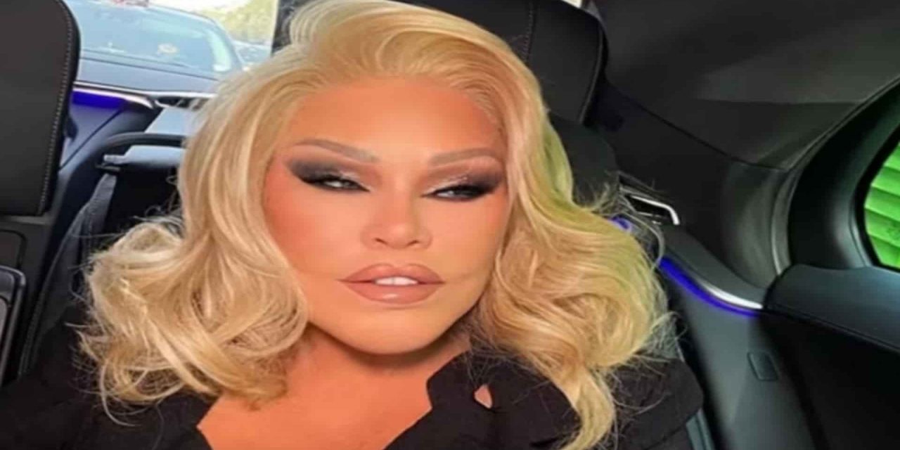 Choc nel mondo dello spettacolo: addio alla “Donna Gatto”, oltre 2 milioni spesi in chirurgia estetica