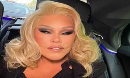 Choc nel mondo dello spettacolo: addio alla “Donna Gatto”, oltre 2 milioni spesi in chirurgia estetica