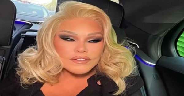 Choc nel mondo dello spettacolo: addio alla "Donna Gatto", oltre 2 milioni spesi in chirurgia estetica