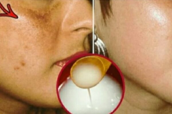 Come eliminare le rughe in modo naturale