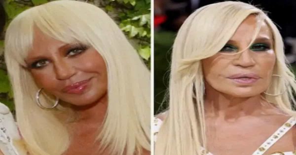 Donatella Versace: la trasformazione che fa parlare il web