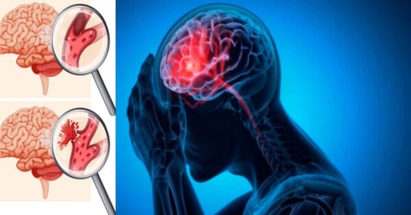 Ecco la Verdura Miracolosa che Può Prevenire l'Ictus, Secondo gli Scienziati!