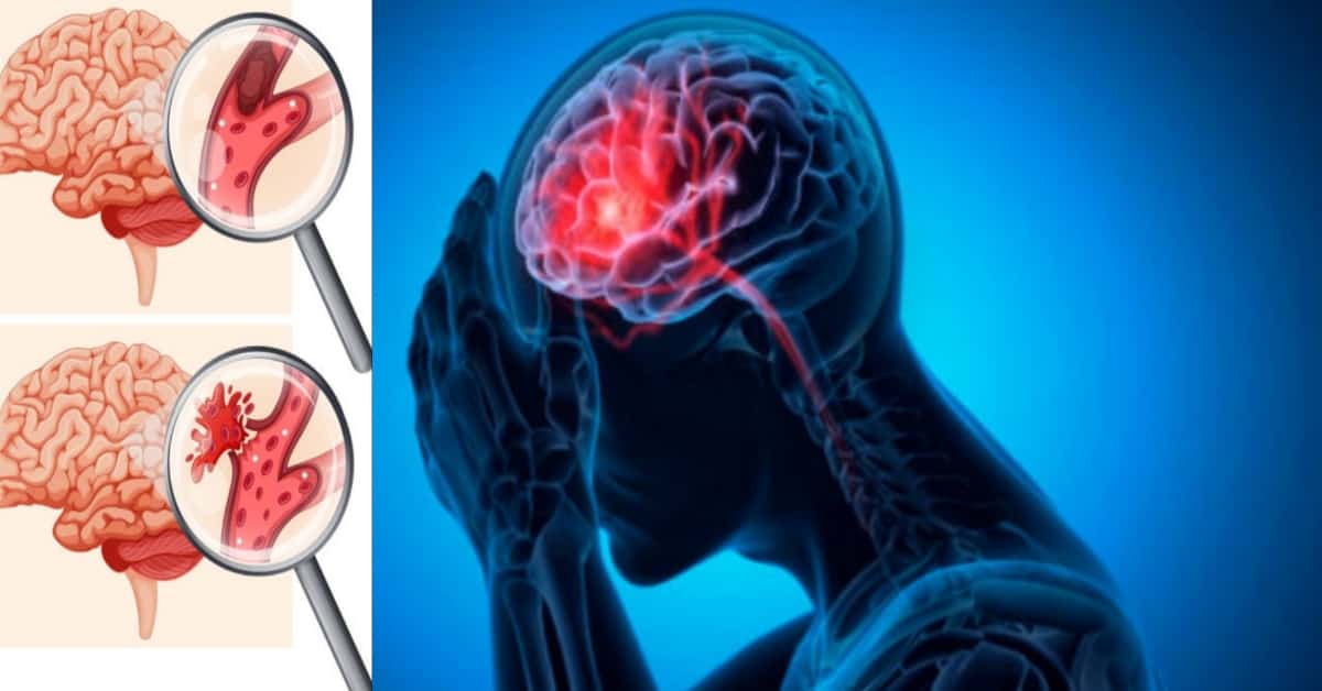 Ecco la Verdura Miracolosa che Può Prevenire l’Ictus, Secondo gli Scienziati!