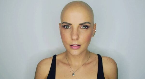 Elisa di Iorio e il cancro. Ecco la sua verità