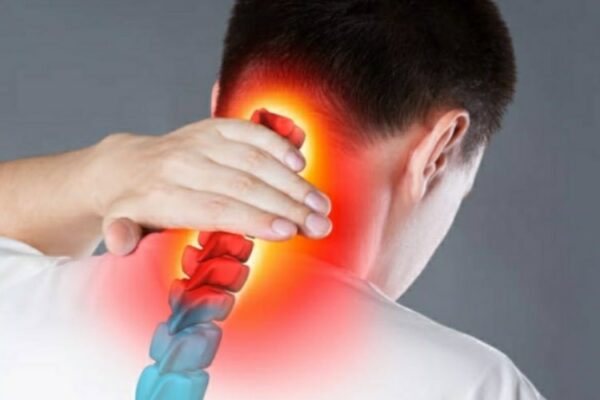 Ernia discale cervicale