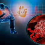 Infarto e rischio: arriva il nuovo test che può prevedere il rischio di recidiva e salvare vite!