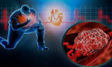 Infarto e rischio: arriva il nuovo test che può prevedere il rischio di recidiva e salvare vite!