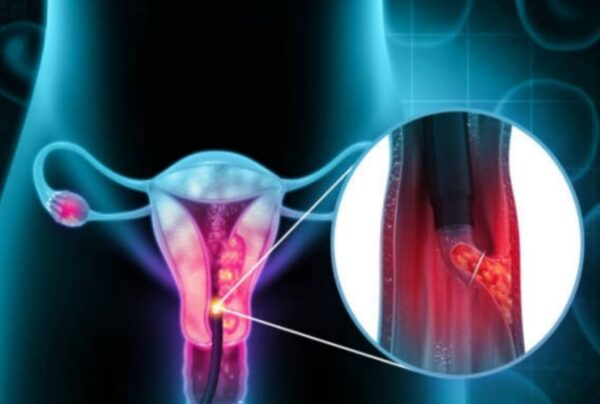 La Cura Contro il Cancro di Cui Nessuno Parla