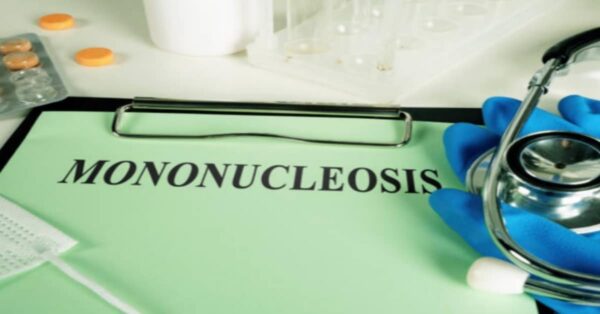 La mononucleosi spesso chiamata malattia del bacio