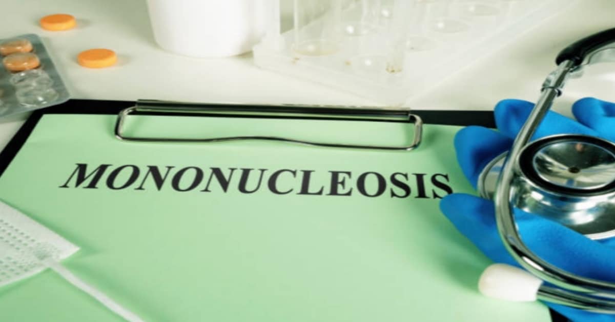 “Mononucleosi: Riconoscere i Sintomi e le Migliori Strategie di Recupero”
