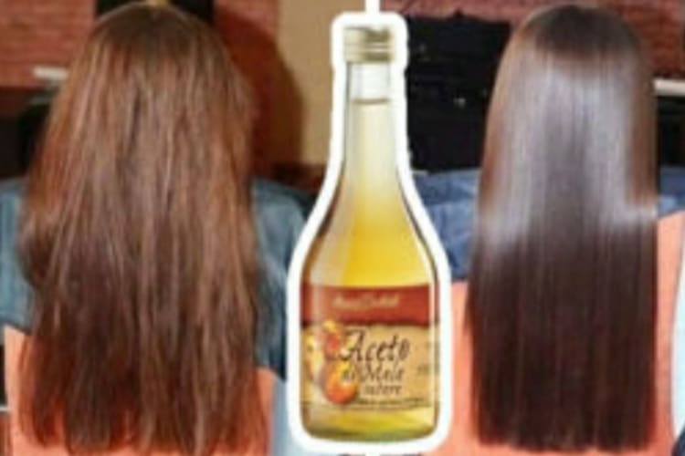 L’aceto può essere un alleato della tua bellezza: Ecco come utilizzarlo