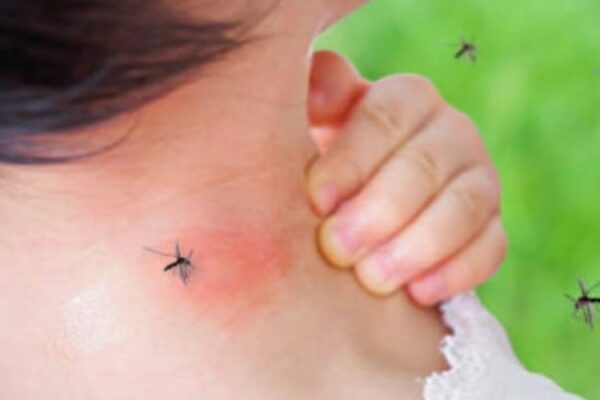 Le zanzare ti danno il tormento? Scopri perché sono attirate da te!