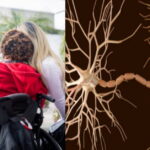 Sclerosi multipla, la svolta: scoperto il virus “silenzioso” che può scatenarla