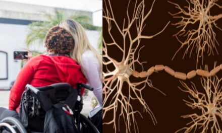 Sclerosi multipla, la svolta: scoperto il virus “silenzioso” che può scatenarla