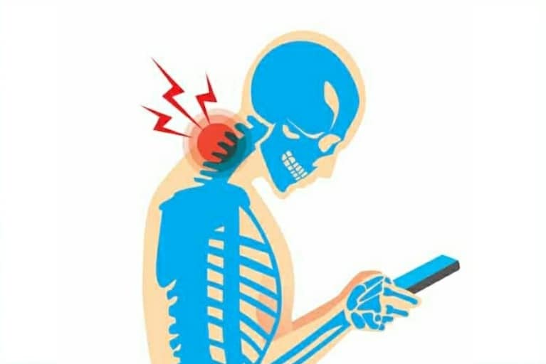 La sindrome Text Neck: di cosa si tratta