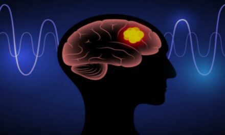 Tumore al cervello: cosa sapere davvero sul glioblastoma