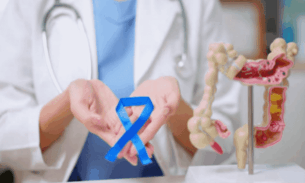 Tumore al colon-retto: scoperta un’alleanza naturale contro le metastasi