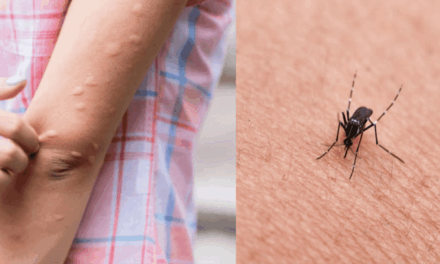 Zanzare: ecco perché alcuni persone diventano bersagli viventi e altri no
